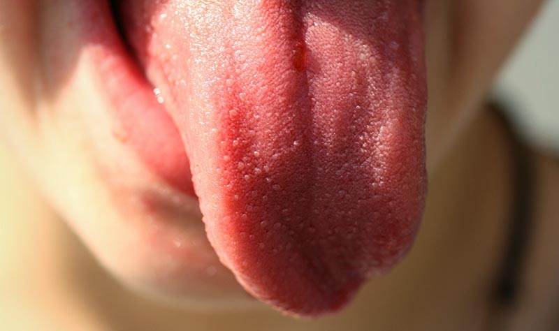 Großaufnahme einer herausgestreckten Zunge